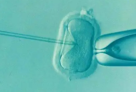 徐州供卵试管女孩-对于试管婴儿取卵，女性的卵泡必须小于18毫米，一般来说，这些卵泡还没有发育。